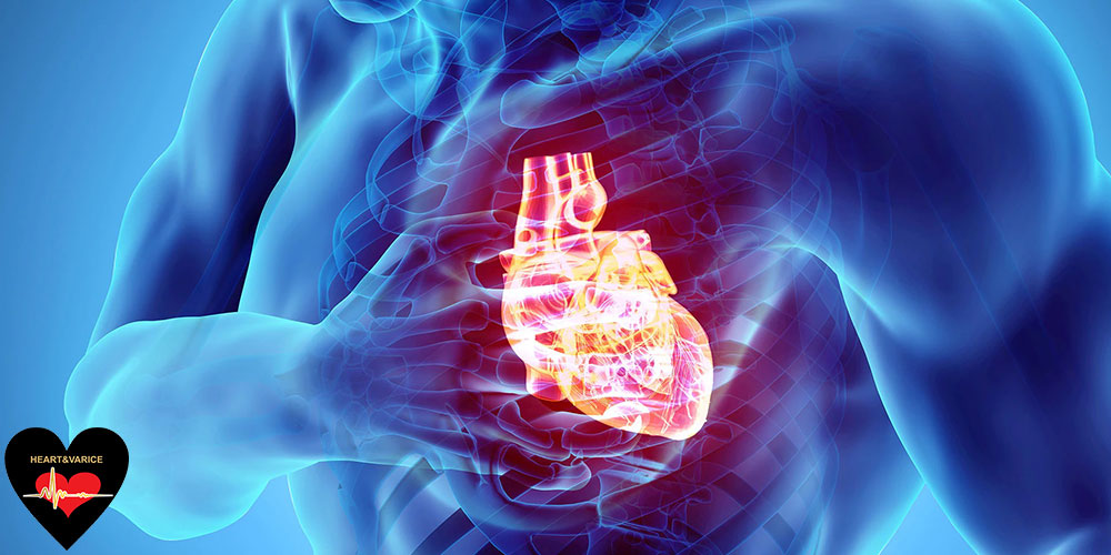 آنژیوگرافی قلب چیست و چه افرادی باید تحت آنژیوگرافی قلب قرار بگیرند؟