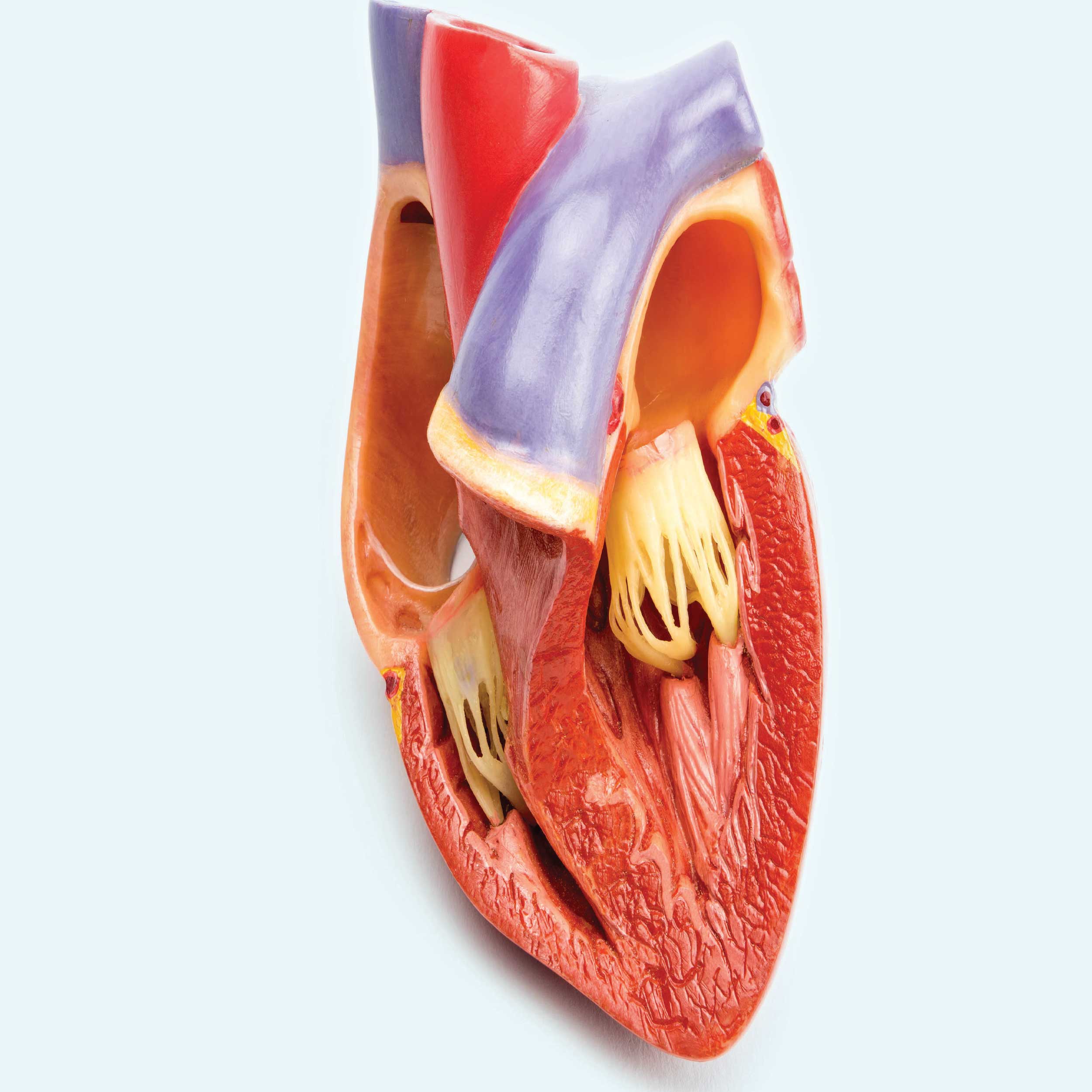 در کاردیومیوپاتی عضلات قلب بزرگ شده و قدرت خون‌رسانی کم می‌شود.