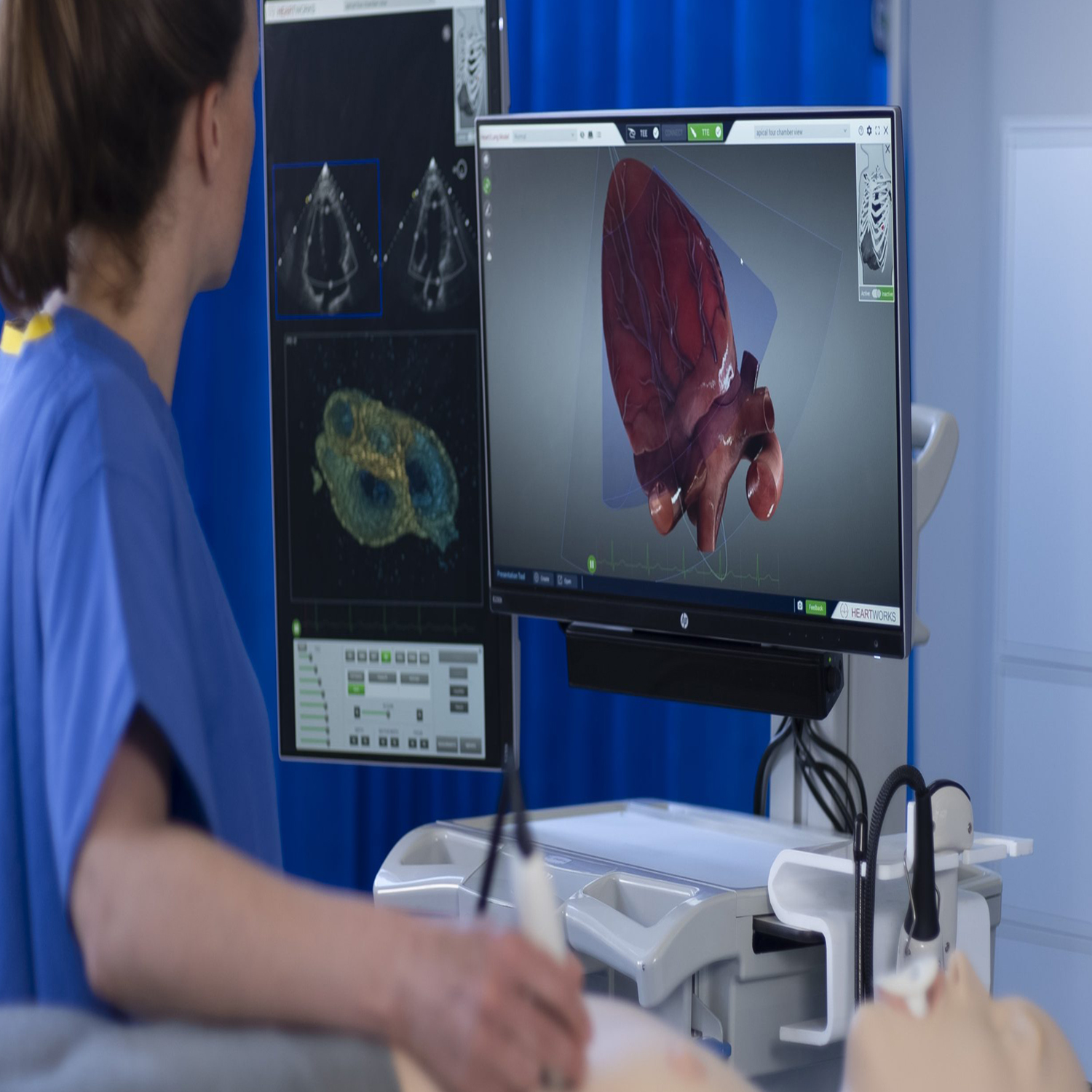 از اکوکاردیوگرافی برای بررسی اندازه، شکل و کارکرد قلب استفاده می‌کنند.
