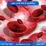 پیشگیری از لخته شدن خون