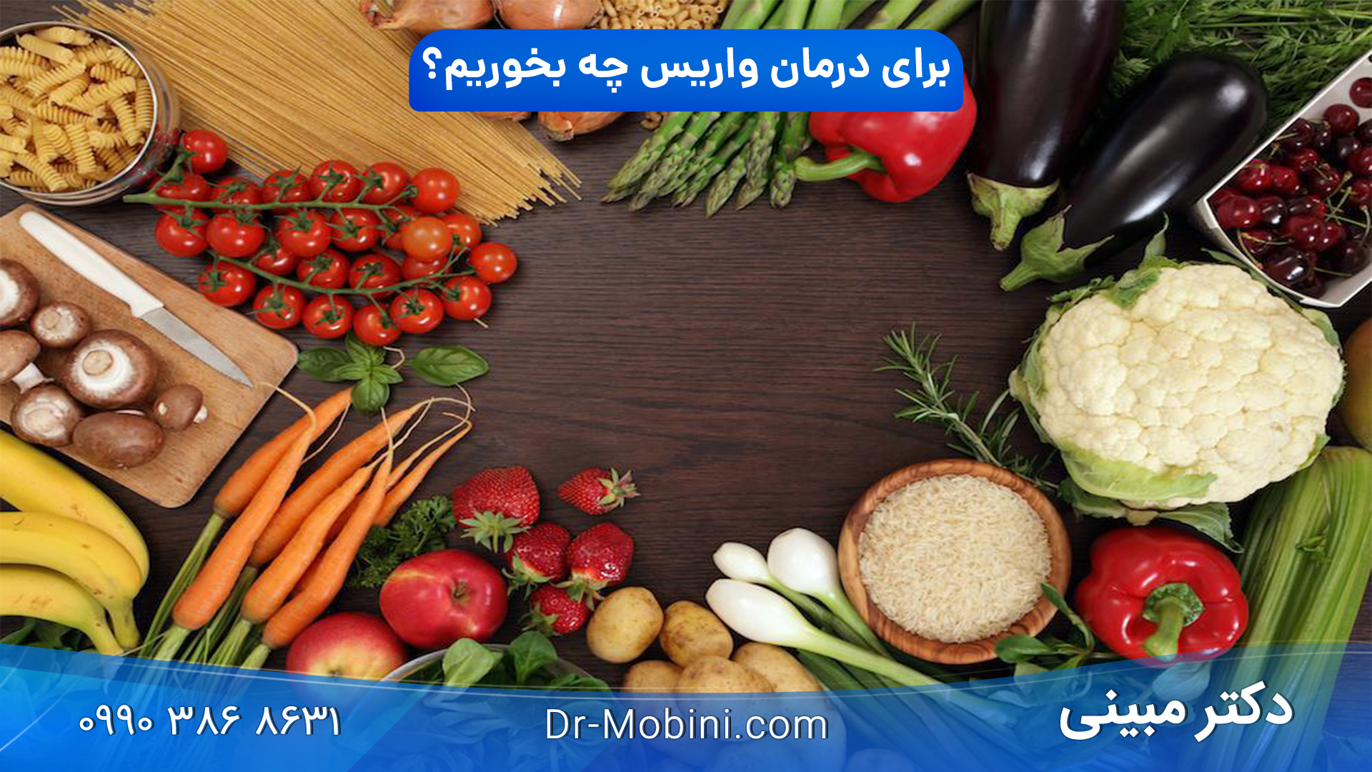 برای درمان واریس چه بخوریم؟