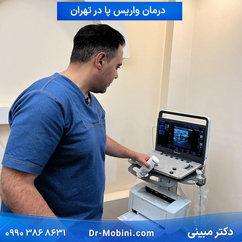 بررسی بیمار توسط دستگاه برای درمان واریس